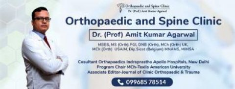 Total Knee Replacement Surgery In Delhi - Dr. Amit Kumar Agarwal