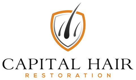 Capital Hair Restoration - Hair Transplant