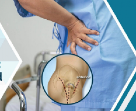 Top Hip Surgeries Hospitals in India