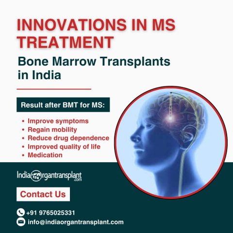 Affordable BMT for Multiple Sclerosis Treatment in India