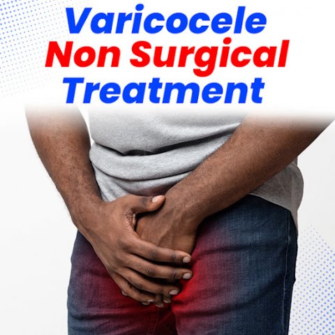 Best Varicocele treatment