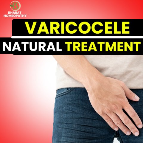 Varicocele Symptoms Diagnosis and Natural Treatment with Homeopathy