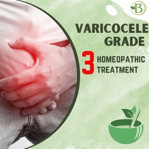 cure varicocele without surgery