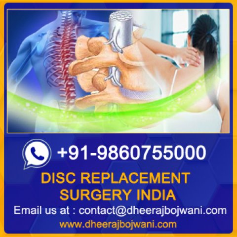 Cost of Artificial Disc Replacement surgery in India