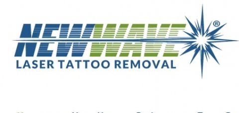 New Wave Laser Tattoo Removal