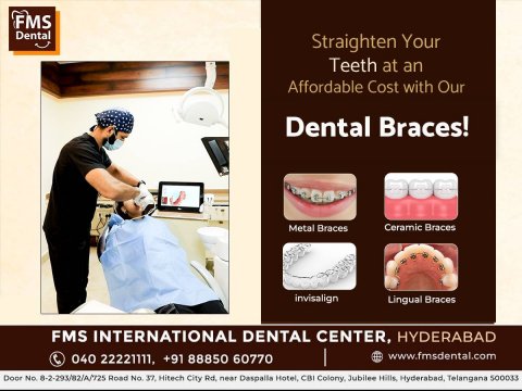 Affordable Braces Cost in Hyderabad, India – FMS Dental
