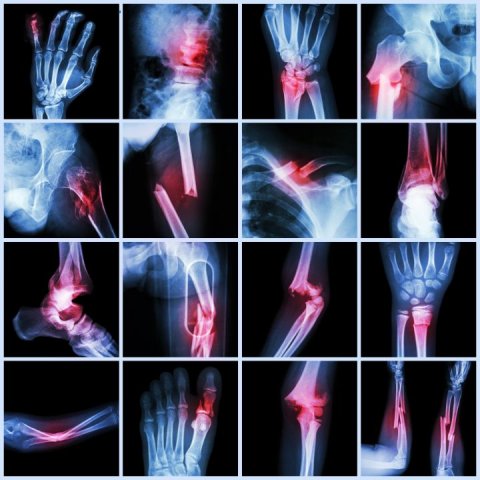 Dr ketan naik orthopaedic surgeon