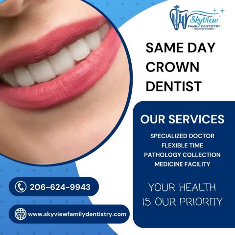 Restore Your Smile Fast with a Same Day Crown Dentist at SkyView Family Dentistry