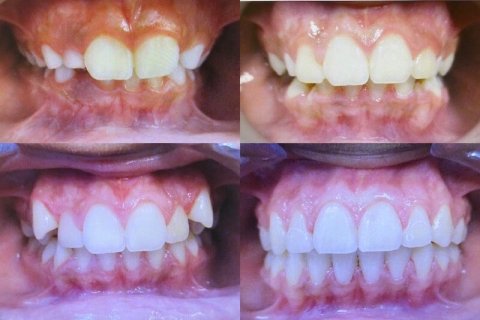 Monterey Park Orthodontist