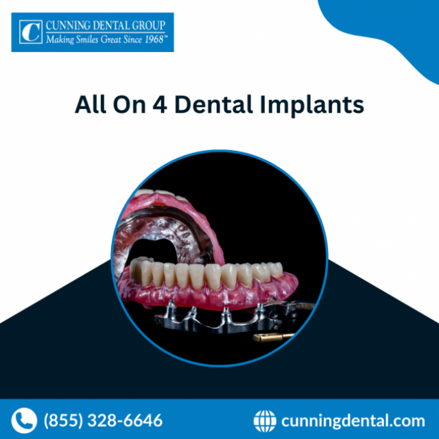 All On Four Dental Implants | Cunning Dental - 4 Generations of Care