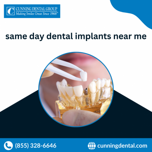 Same Day Dental Implants In CA | Cunning Dental Group
