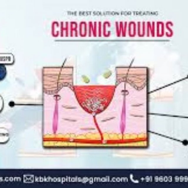 Cost of Chronic Wounds Treatment in hyderabad