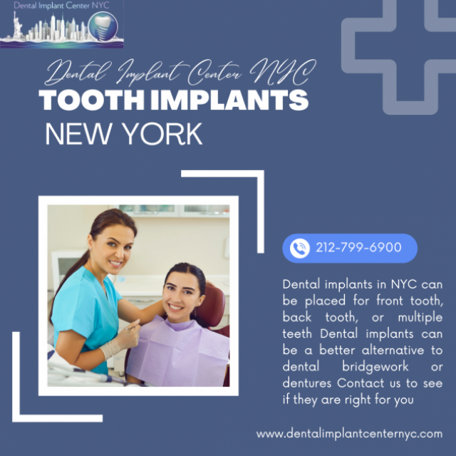 Dental Implant Center NYC