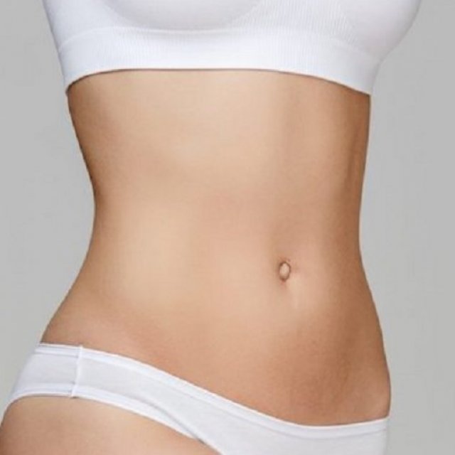 Liposuction in Islamabad