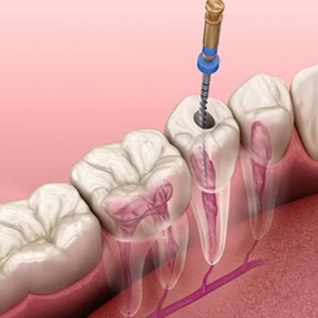 Cusp Dental & Maxillofacial Centre