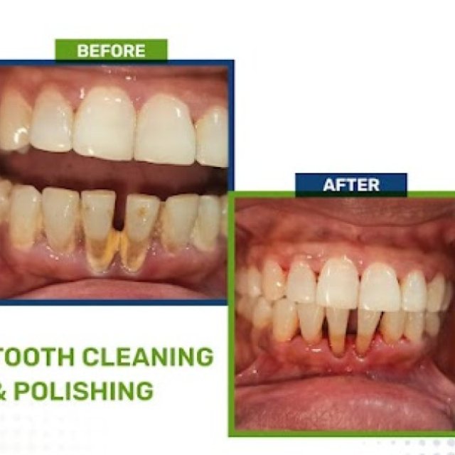 Dentalign - Family Dental Care