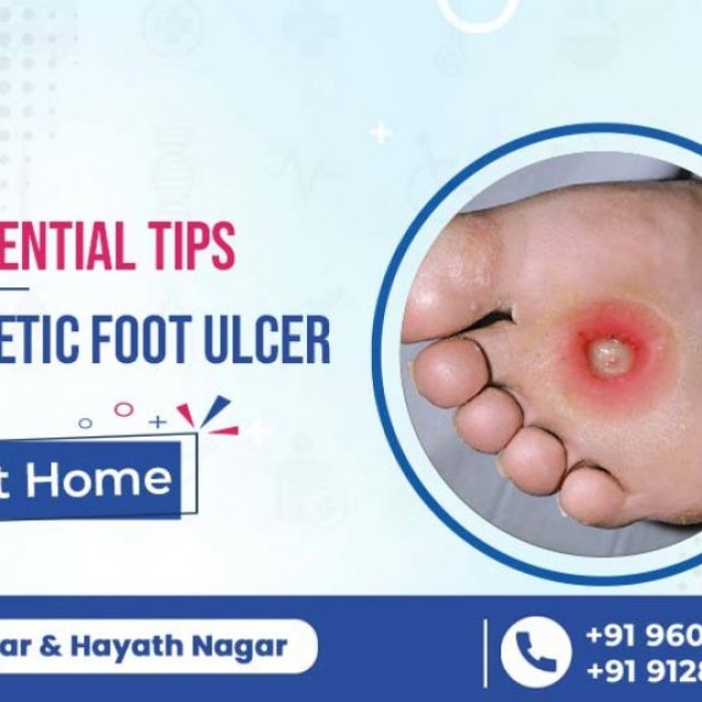 Non - Surgical Diabetic Foot Ulcer Treatment