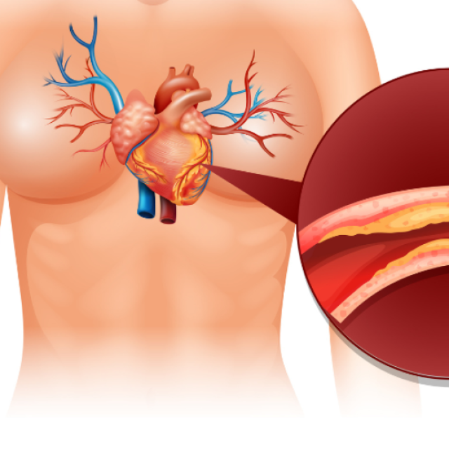 CT Coronary Angiography Pricing Explained with Benefits Overview