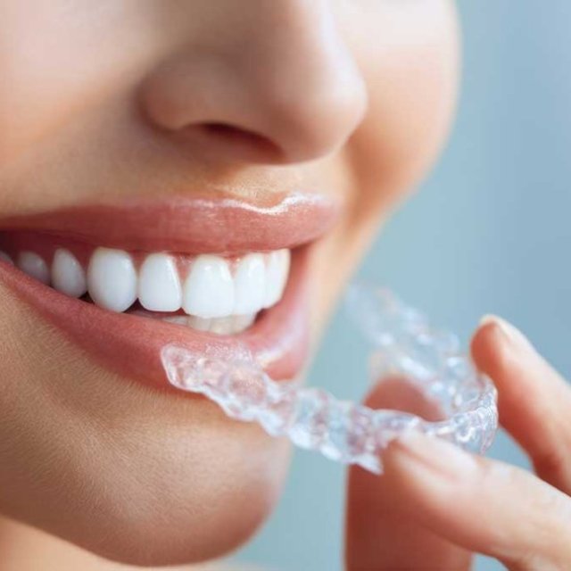 Tacoma Advanced Dental | Dr. Petrie