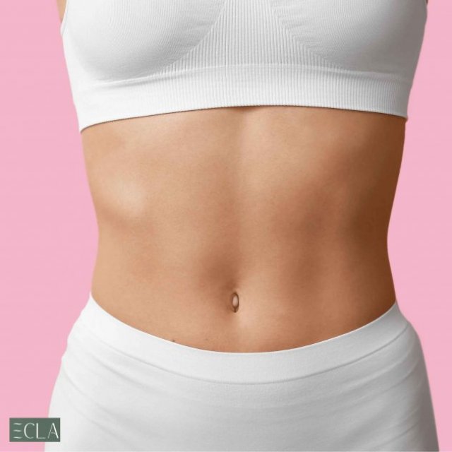 Abdominoplasty in Dubai - Ecla Clinic