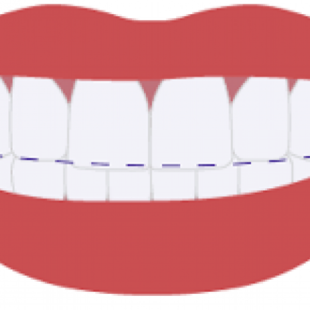 Invisalign in Westwood