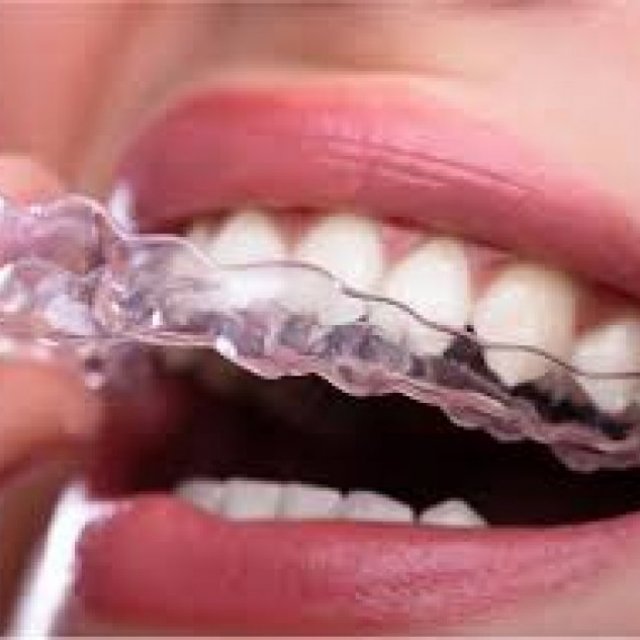 Invisalign in Portland