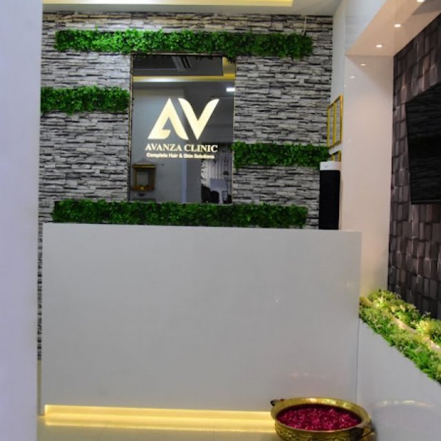 Avanza hair Clinic