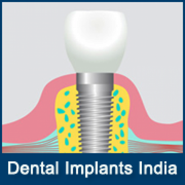 Best Dental Care Clinic in India