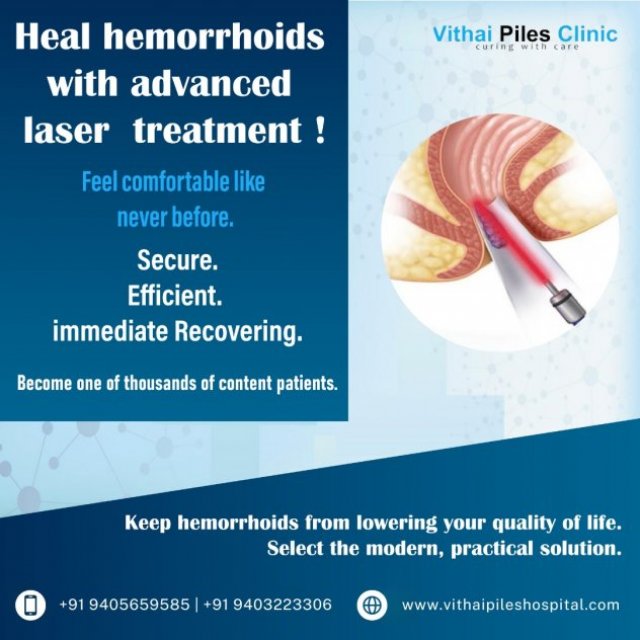 Best laser Treatment for Hemorrhoids in, Pune