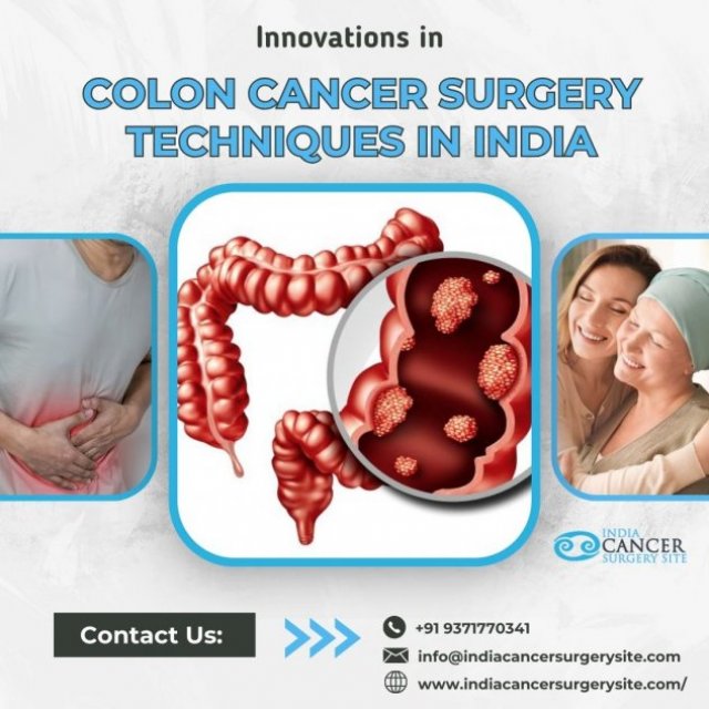 Top  Surgeons for Colon Cancer Treatment India