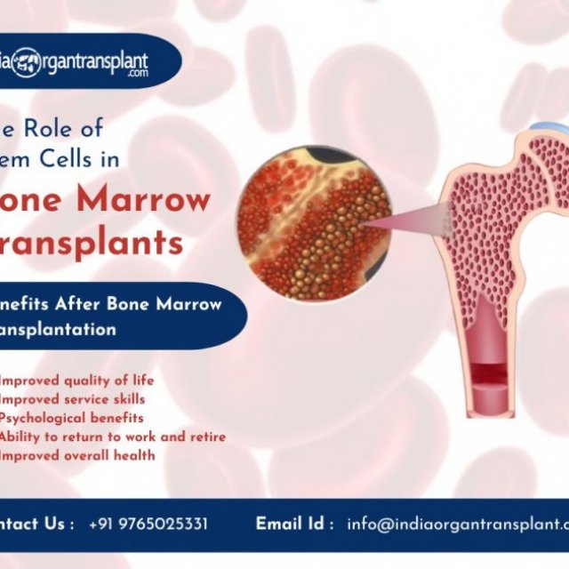 Best Hospitals for Bone Marrow Transplant in India