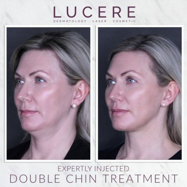 Lucere Dermatology and Laser Clinic