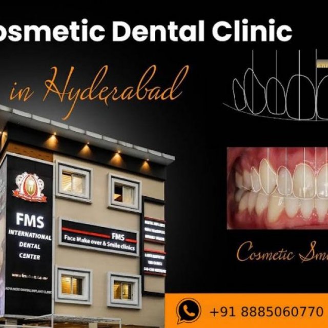 FMS Cosmetic Dental Clinic - Best Dental Clinic in Jubilee Hills, Hyderabad