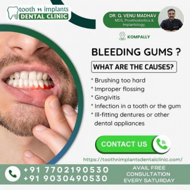 Best dental clinic kompally | Top denstist in Suchitra | Best dental hospital Alwal