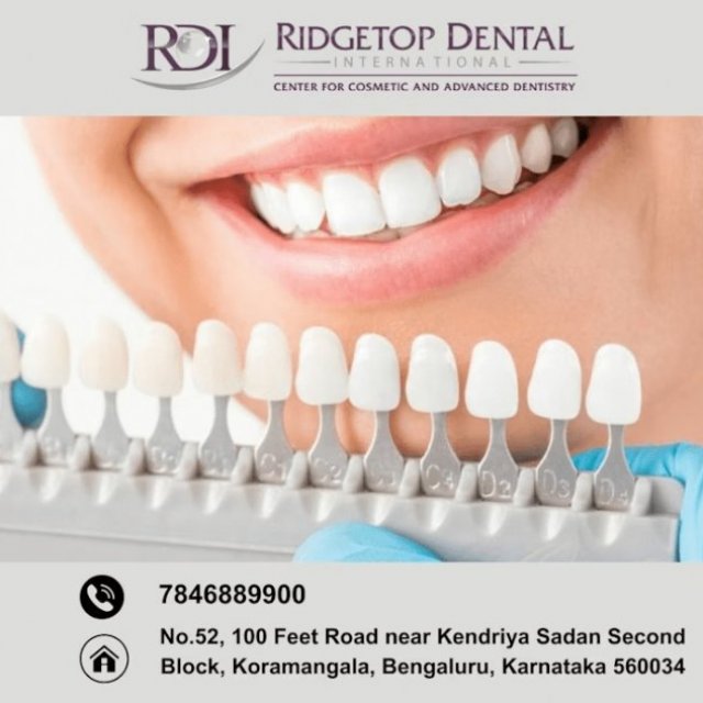 Best Dental Clinic in Koramangala | Ridgetop Dental International