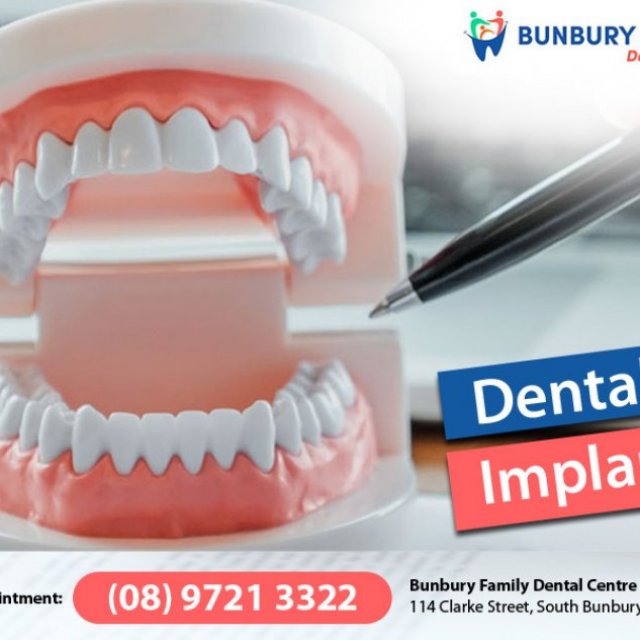 Dental Implants Bunbury WA 6230 - All on 4 Dental Implants - Bunbury Family Dental Centre