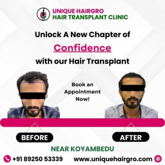 Unique Hair Grow Hair Transplant Clinic