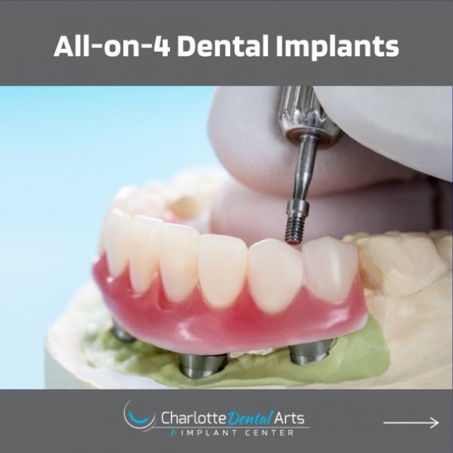 Charlotte Dental Arts & Implant Center