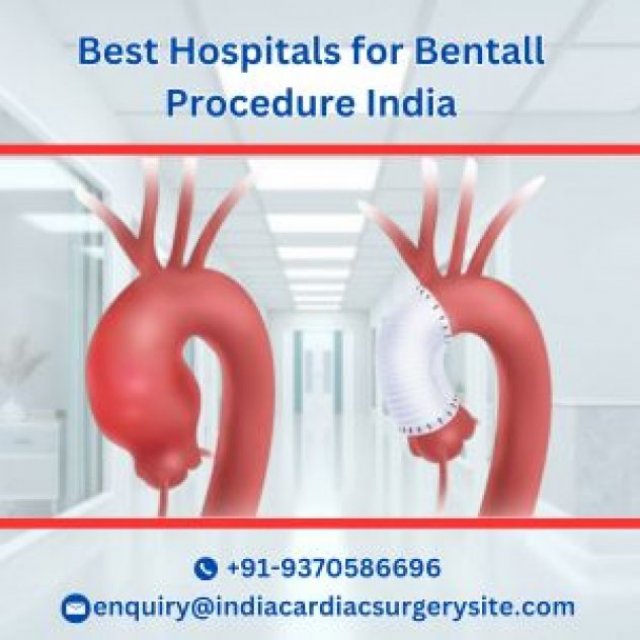 Bentall Procedure In India