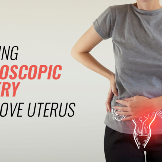 Laparoscopic Surgery To Remove Uterus | World of Urology