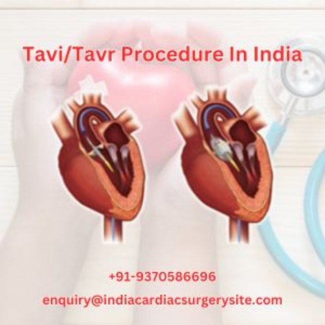 Best Tavi surgeon in india