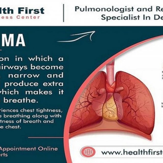 Looking for The Best Asthma Doctor Near Me? Choose Dr. Sanchayan Roy!