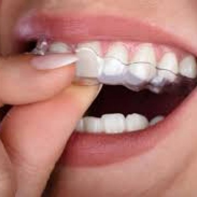 Shorewood Invisalign