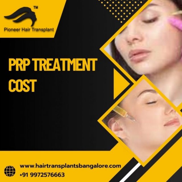 Hair Transplant Banglore