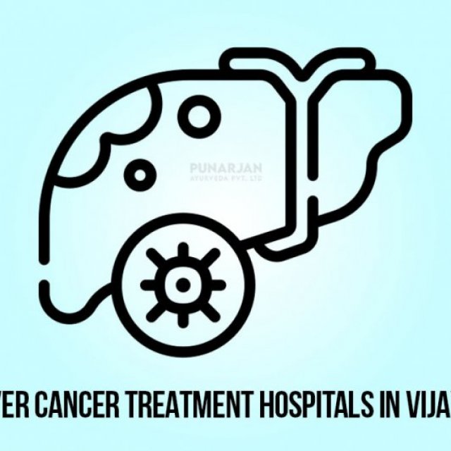 Best Liver Cancer Hospital in Vijayawada