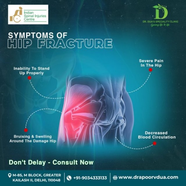 Dr. Apoorv Dua|best orthopedic surgeon greater kailash|best knee replacement doctor in greater kailash