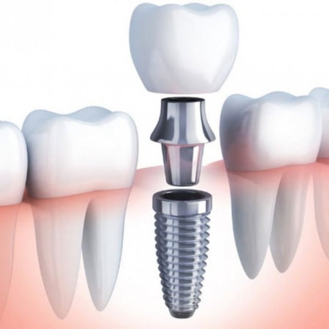 Capital Dental Care in Madinaguda and Kondapur, Hyderabad