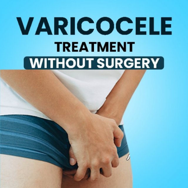 Best Varicocele treatment