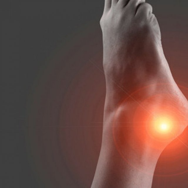 Dr. Chris Sakowski, MD | Achilles Tendon Repair Surgeon