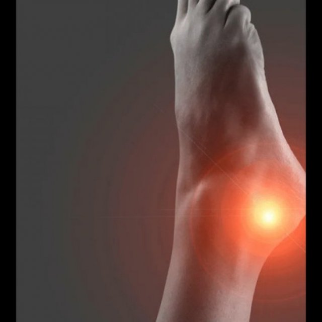 Dr. Chris Sakowski, MD | Plantar Fasciitis Surgeon